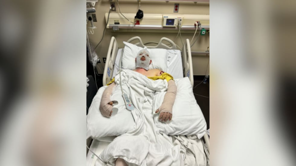 Texas Tech student recovering after being hit by alleged drunk driver