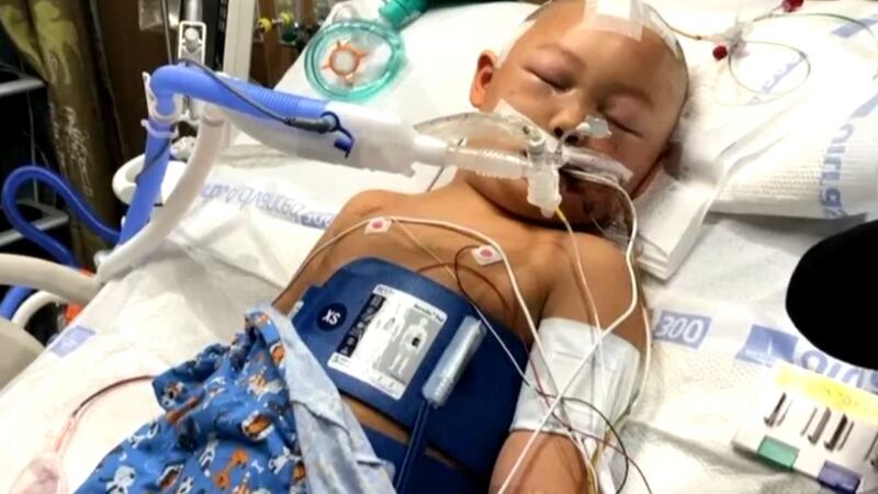 Los documentos judiciales muestran que Jeremy, de 6 años, tiene múltiples fracturas de cráneo...