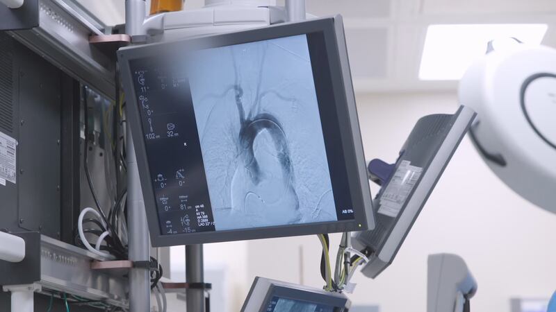 Nuevos análisis de sangre podrían determinar el riesgo de sufrir un infarto o derrame cerebral